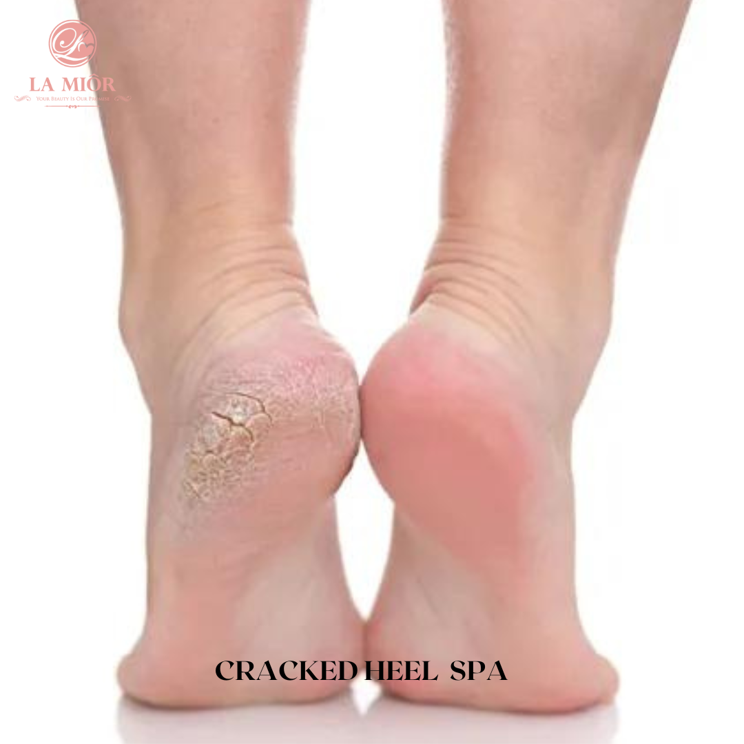 SIGNATURE CRACK HEEL SPA SIGNATURE CRACK HEEL SPA